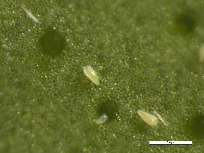 在顯微鏡下之柑橘銹蜱成蟲--將另開視窗看原圖