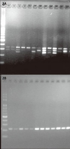 Electrophoresis results for SSR molecular markers.2A. Exhibiting polymorphism. 2B. Not exhibiting polymorphism. 